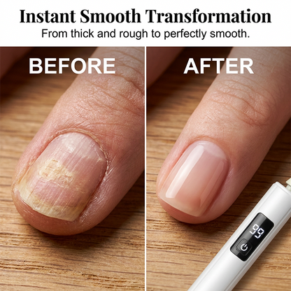 📢📢Limited-Time SALE -ONLY £9.99!!🔥Professional Electric Nail Polisher,Electric Nail Grinder With LED Light,easily shape, smooth, polish, or remove gel according